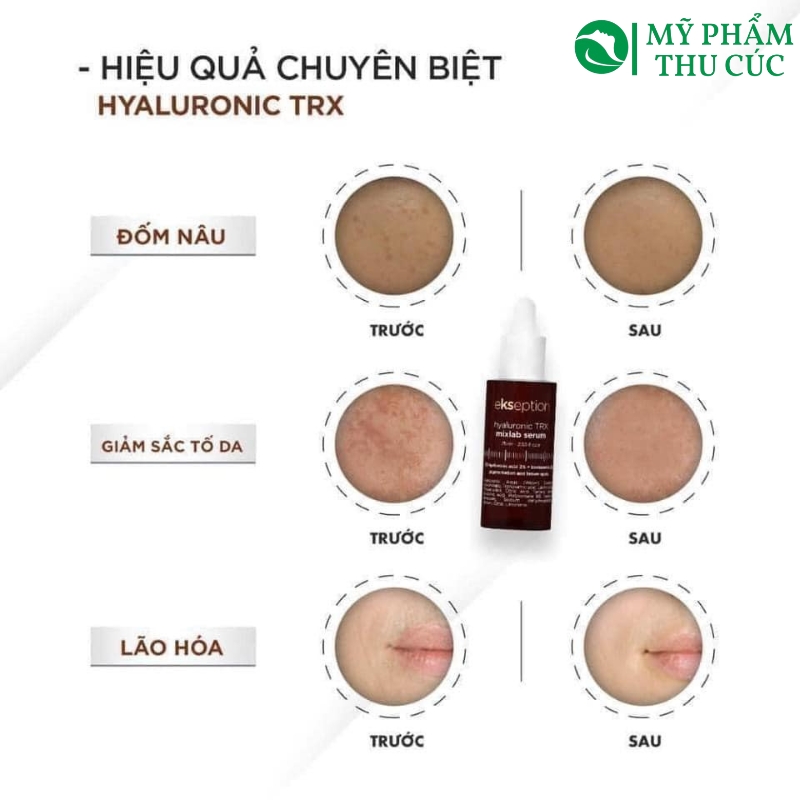 Serum Ekseption Hyaluronic TRX phù hợp cho mọi làn da