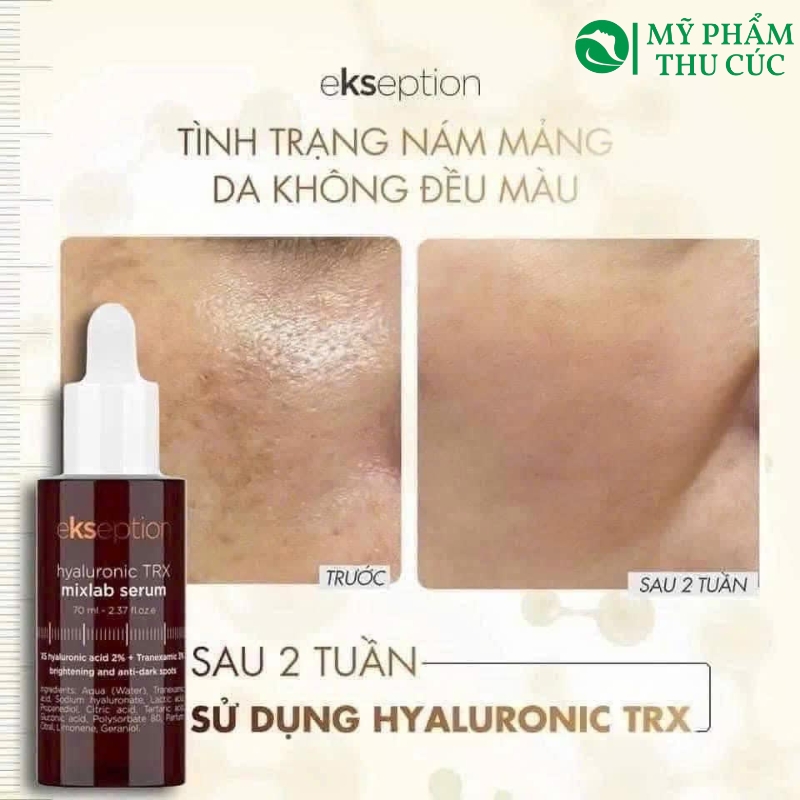 Đánh giá hiệu quả sử dụng Ekseption Hyaluronic TRX serum