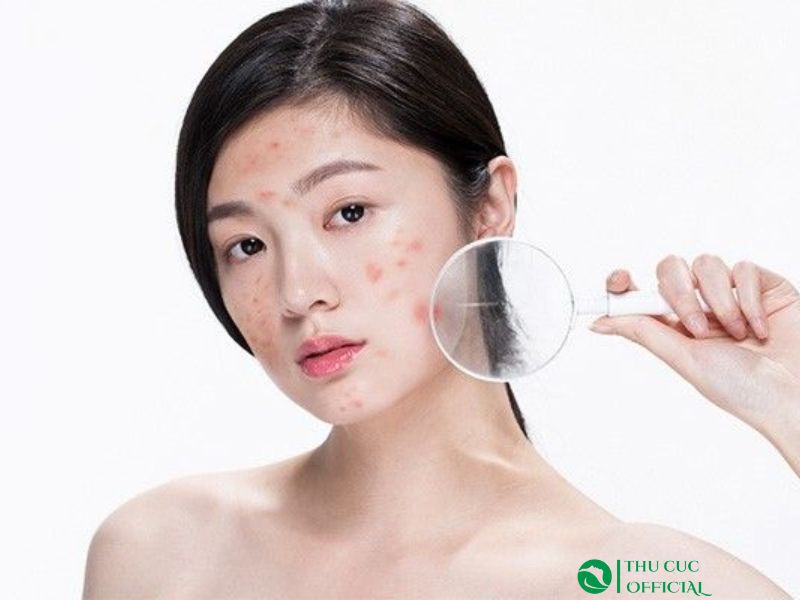 Sữa rửa mặt cho da dầu