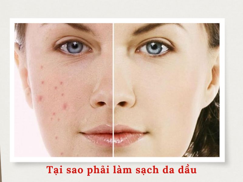 Tại sao phải làm sạch da dầu