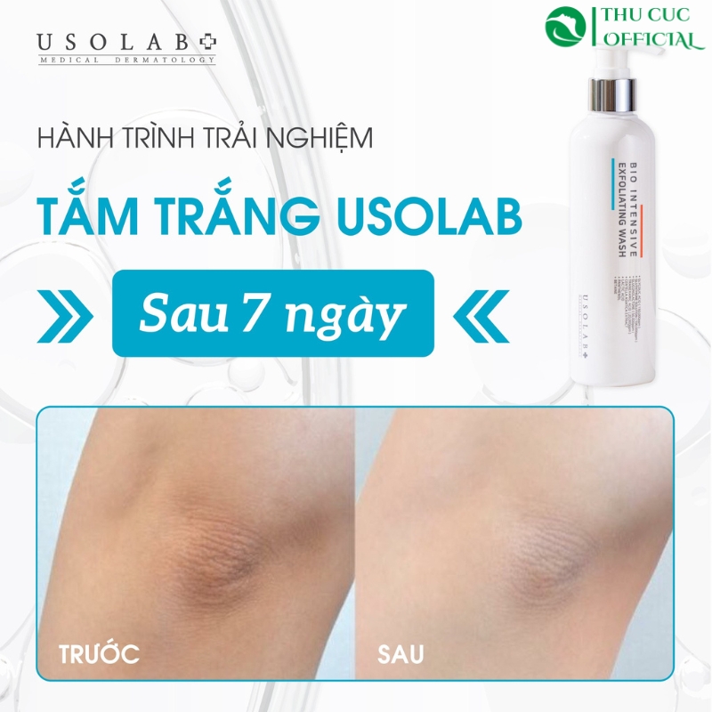 Tắm trắng Usolab hiệu quả sau 7 ngày