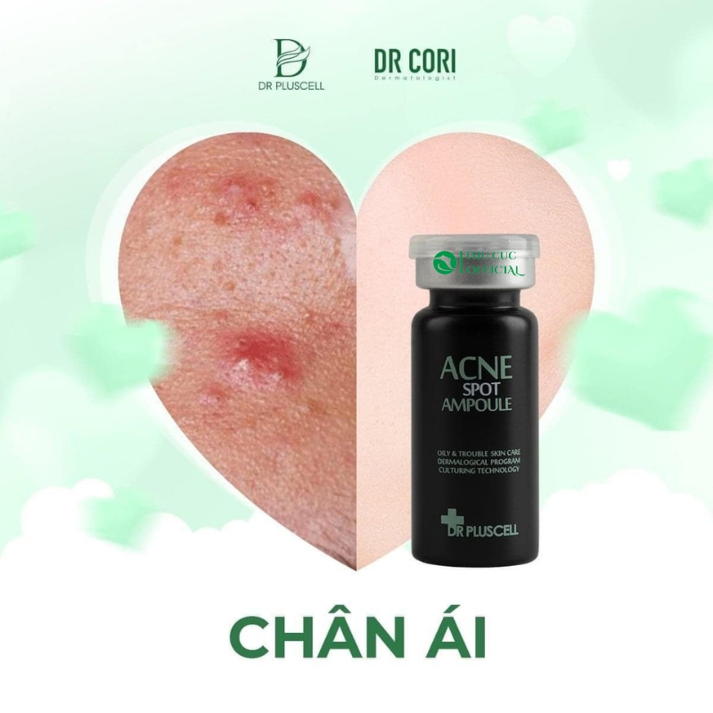 Dr Cori Acne Spot Ampoule chân ái cho da mụn