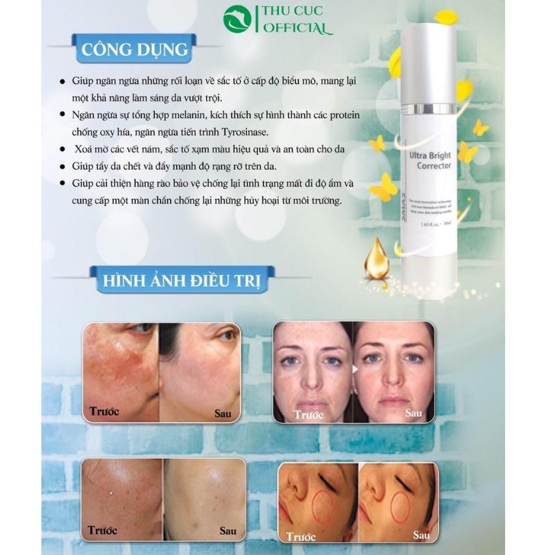 Thông tin về kem nám Smas