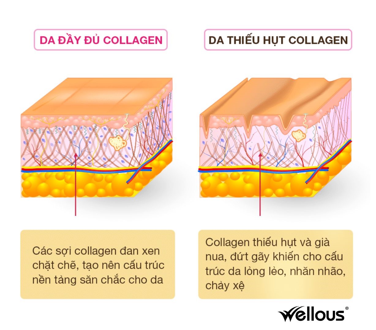Collagen