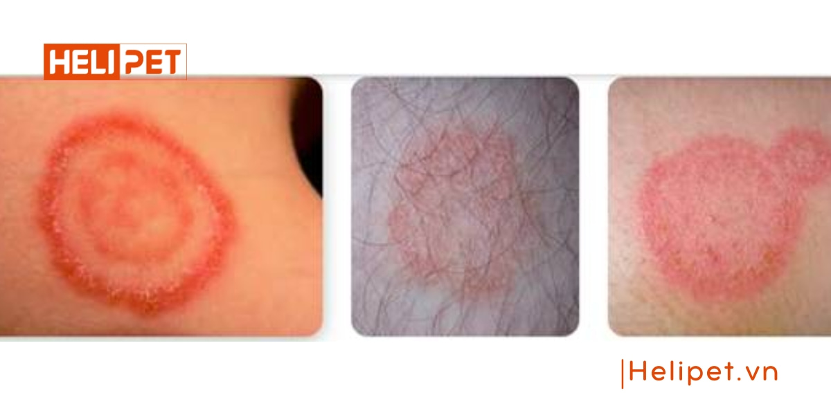 mèo bị nấm có lây sang người không