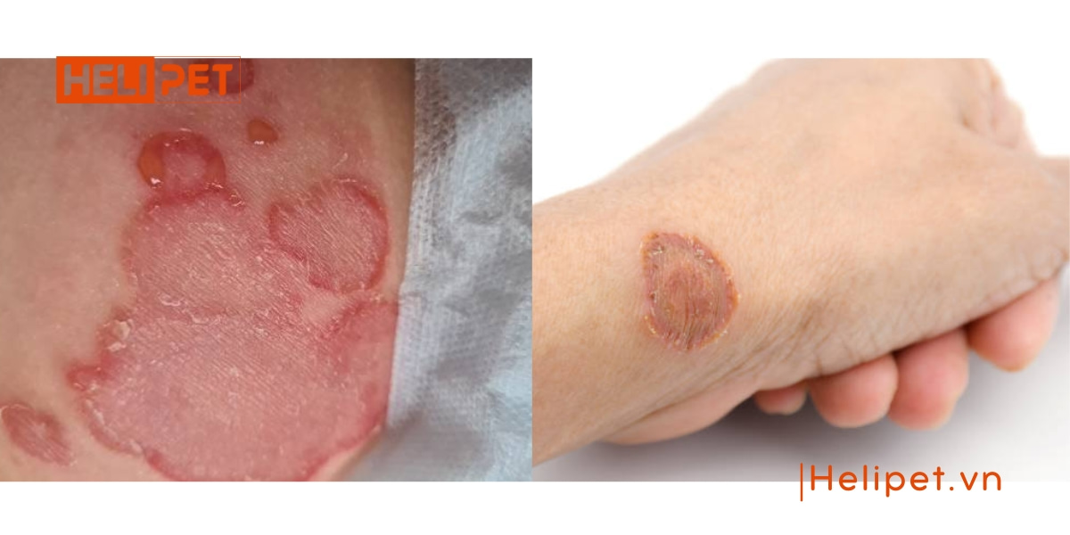 mèo bị nấm có lây sang người không