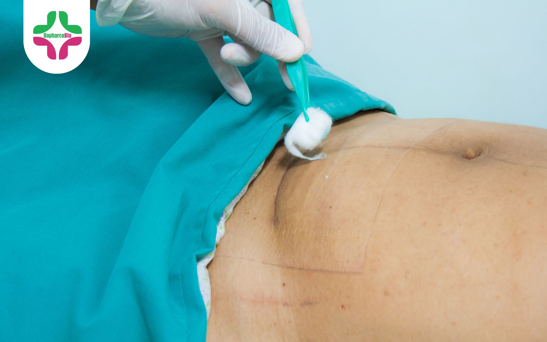 vet-mo-sau-sinh-bi-ngua-tim-hieu-nguyen-nhan-va-cach-xu-ly