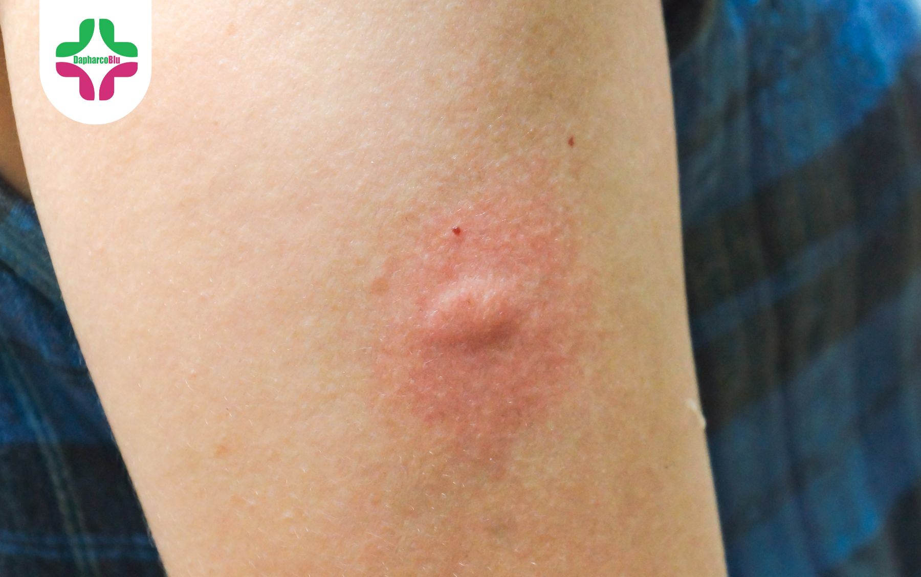 nhan-biet-som-sot-xuat-huyet-dung-bo-qua-nhung-dau-hieu-nay