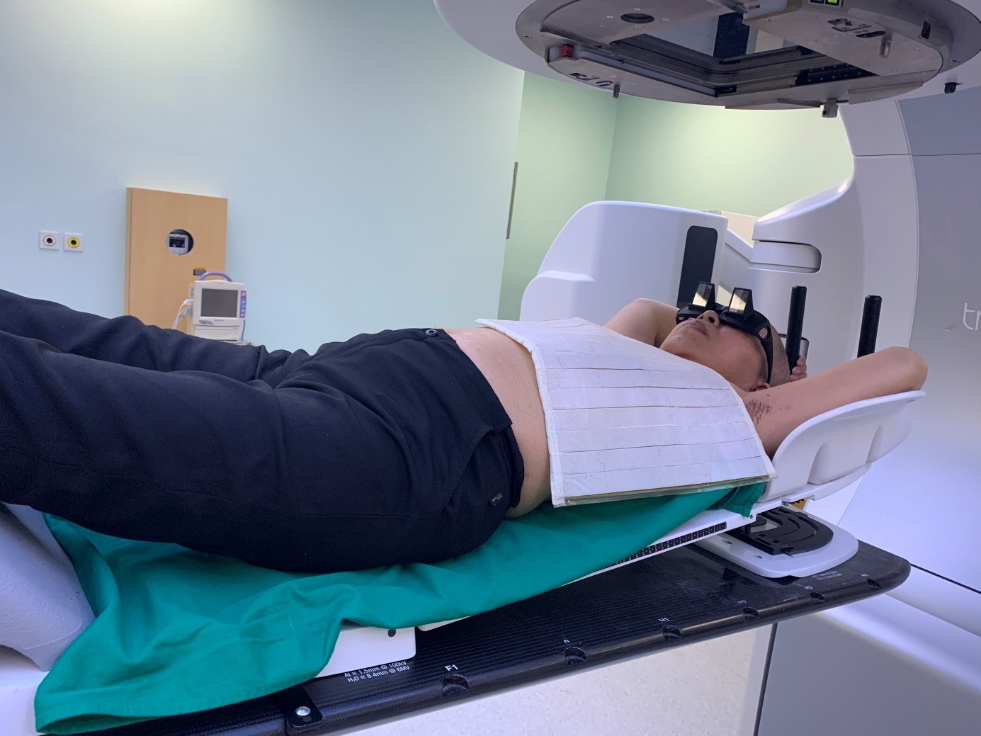 Bệnh nhân bị ung thư vú điều trị phóng xạ