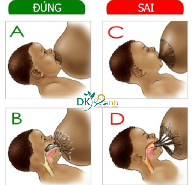 Cho con bú không đúng cách