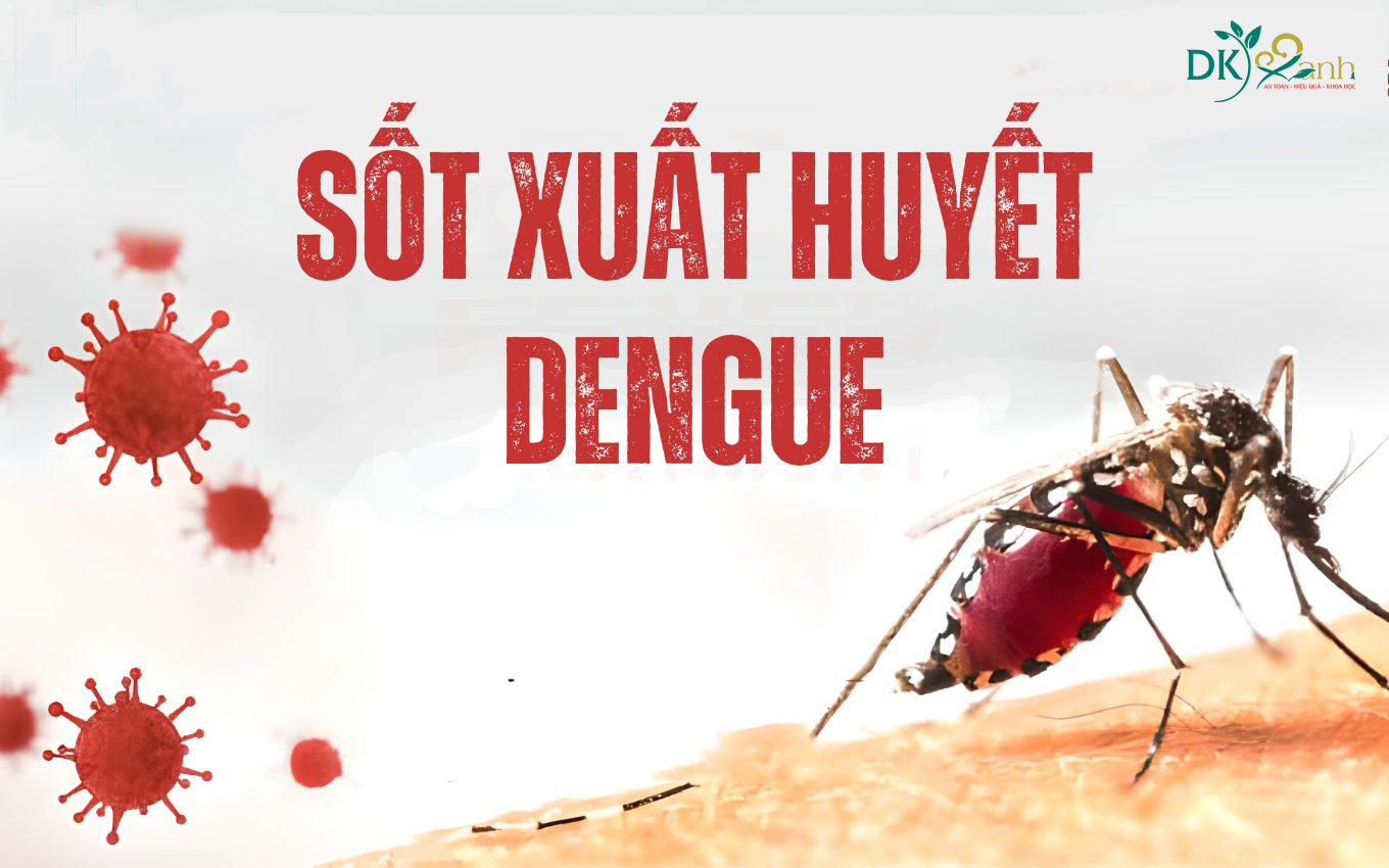 Bệnh sốt xuất huyết Dengue