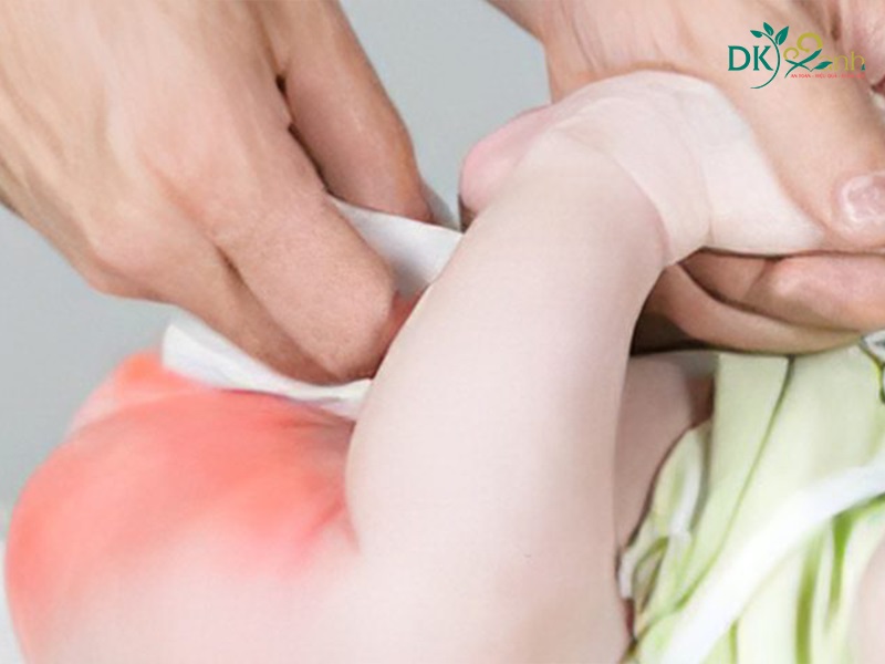 Tạo bởi nấm hoặc nhiễm khuẩn