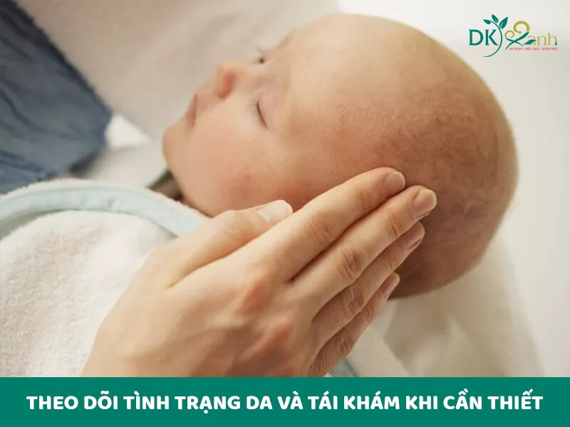 Theo dõi tình trạng da và tái khám khi cần thiết