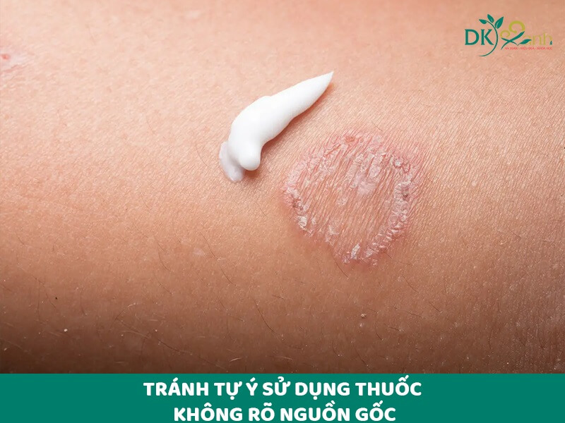 Tránh tự ý sử dụng thuốc không rõ nguồn gốc