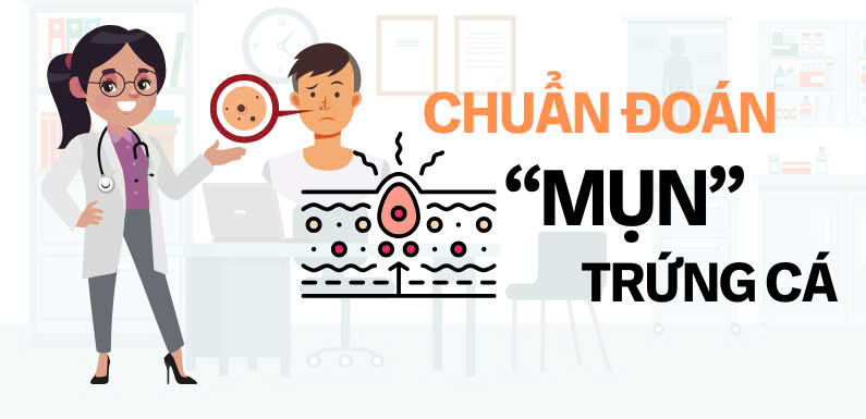 CHẨN ĐOÁN MỤN TRỨNG CÁ
