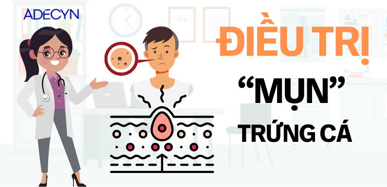 ĐIỀU TRỊ MỤN TRỨNG CÁ