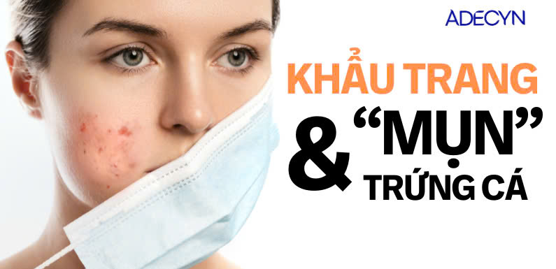 KHẨU TRANG VÀ MỤN TRỨNG CÁ