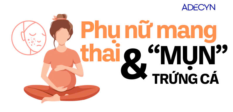 MỤN TRỨNG CÁ Ở PHỤ NỮ CÓ THAI