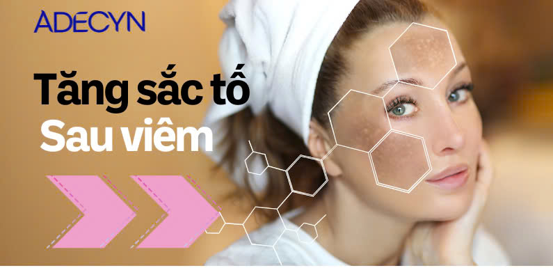 TĂNG SẮC TỐ SAU VIÊM (POST INFLAMMATORY HYPERPIGMENTATION- PIH)