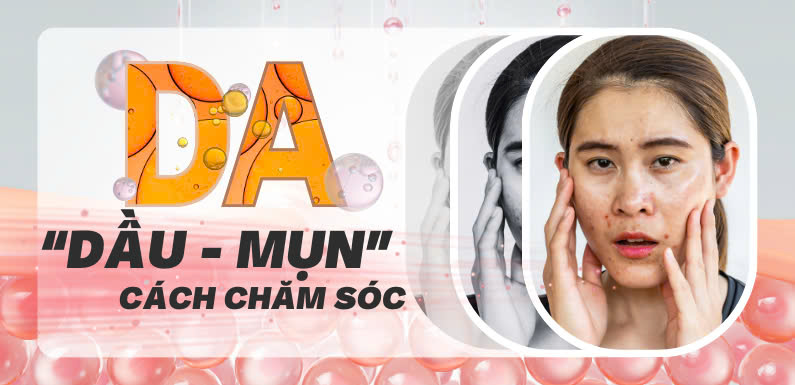 DA DẦU MỤN VÀ CÁCH CHĂM SÓC