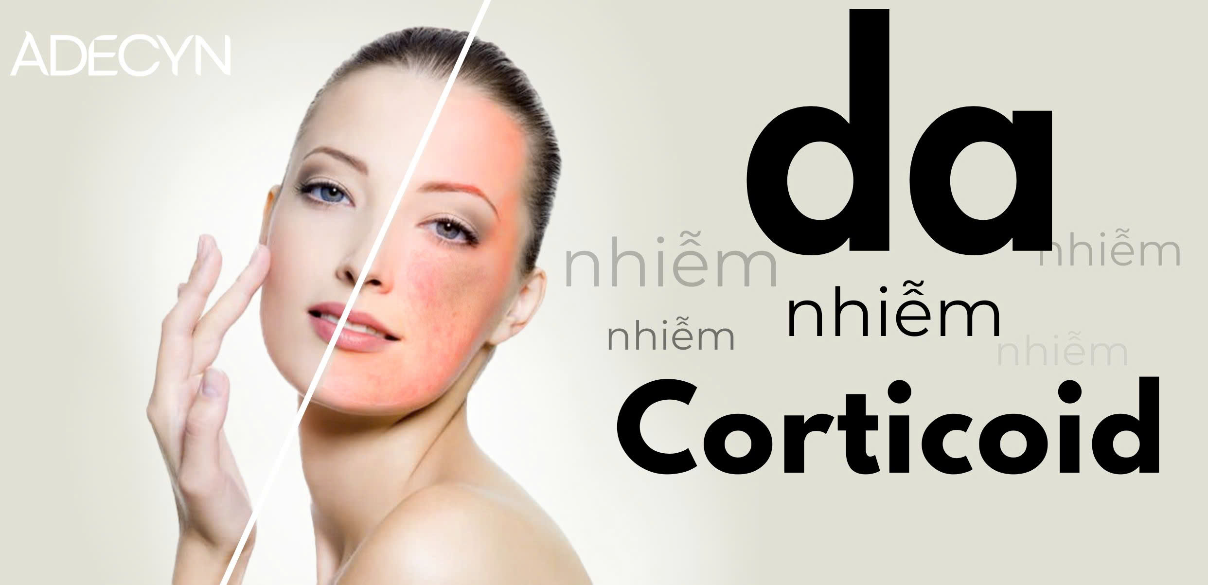 DA NHIỄM CORTICOID