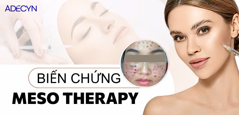 Một số biến chứng của mesotherapy