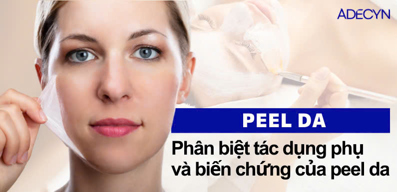 Phân biệt tác dụng phụ và biến chứng sau peel da
