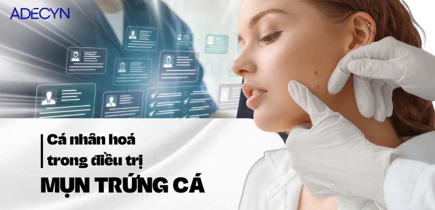 Cá nhân hoá trong điều trị Mụn trứng cá