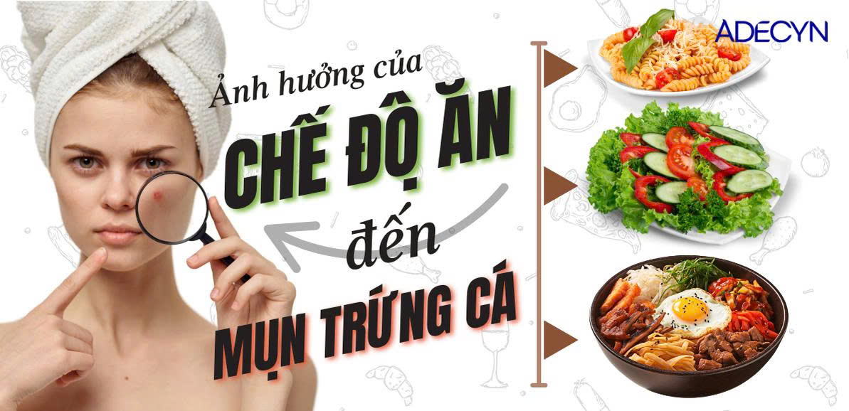 Ảnh hưởng của chế độ ăn với mụn trứng cá