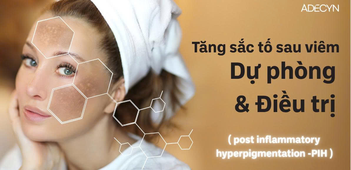 Tăng sắc tố sau viêm, dự phòng và điều trị (Post inflammatory hyperpigmentation – PIH)