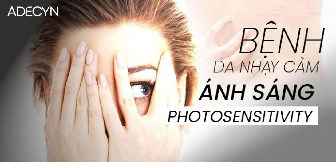 BỆNH DA NHẠY CẢM ÁNH SÁNG (PHOTOSENSITIVITY)