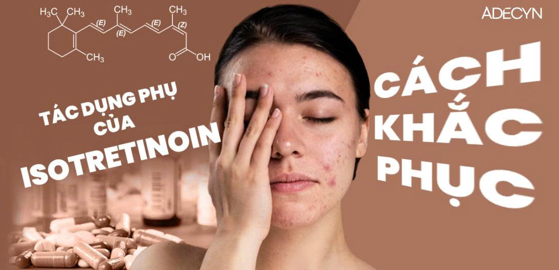 Tác dụng phụ của Isotretinoin và cách khắc phục
