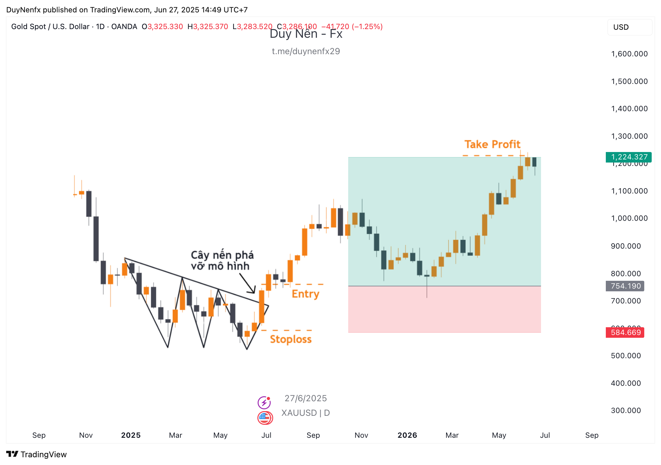 Ví dụ về mô hình 3 đáy