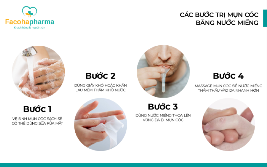 Các bước trị mụn cóc bằng nước miếng