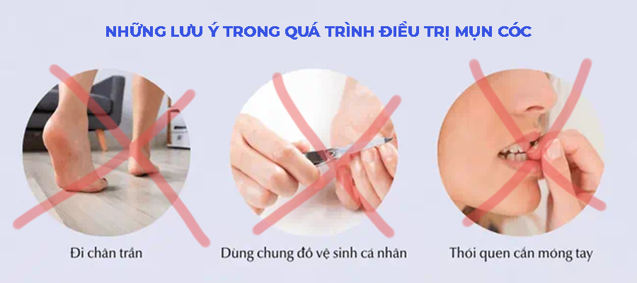 Lưu ý trong quá trình điều trị mụn cóc