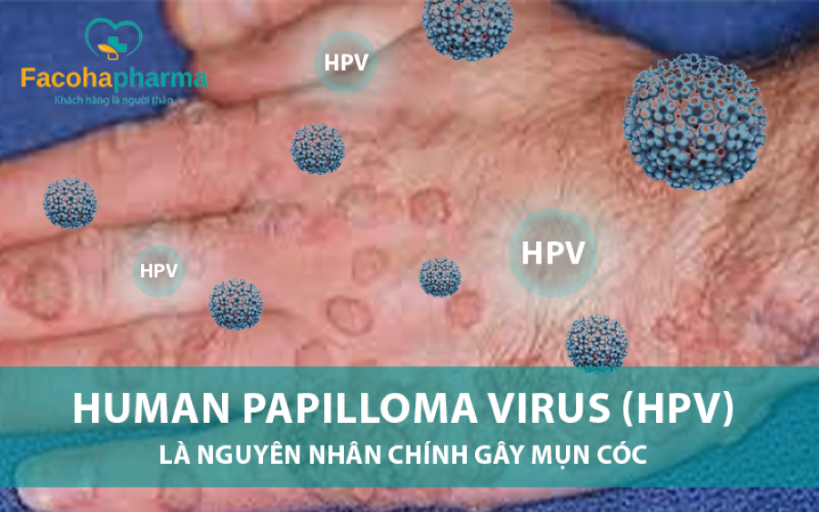 Nguyên nhân dẫn đến mụn cóc do vi khuẩn HPV