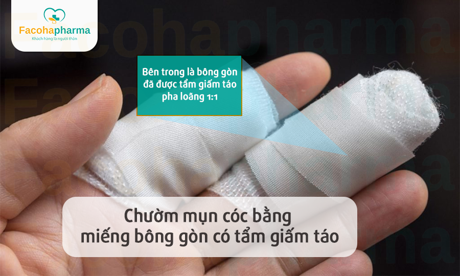 Trị mụn cóc bằng giấm táo