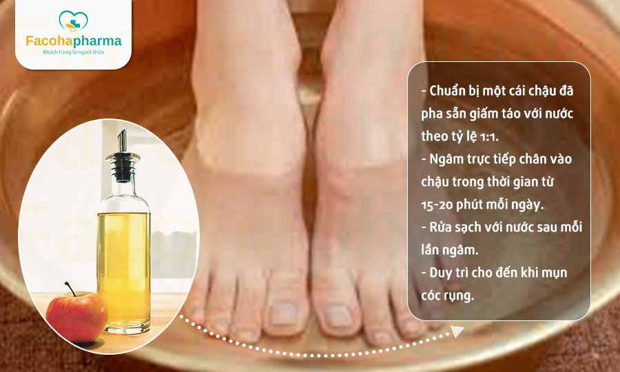 Trị mụn cóc bằng giấm táo