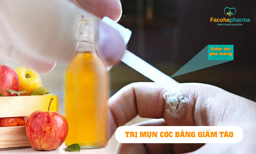 Trị mụn cóc bằng giấm táo