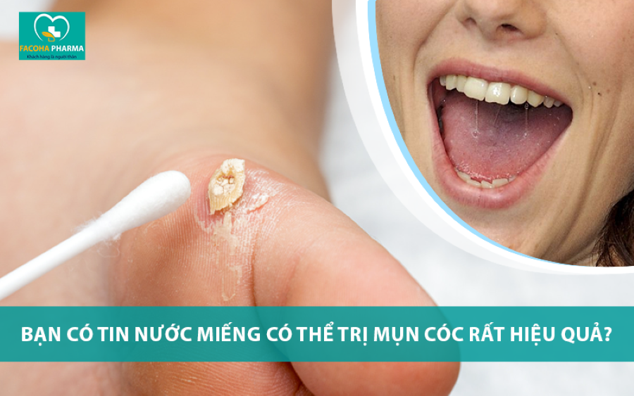 Trị mụn cóc bằng nước miếng