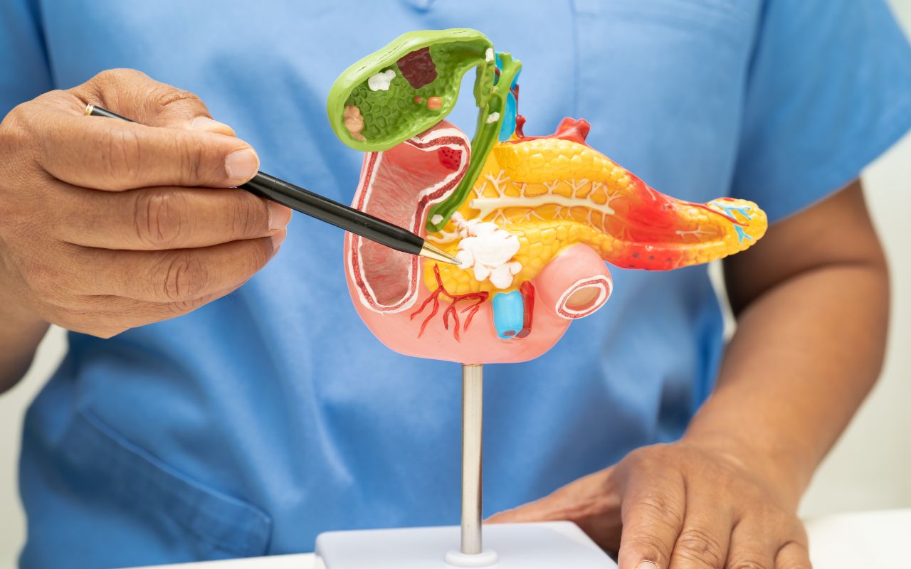 Viêm Tụy Cấp Tính Nên Ăn Gì? Thực Đơn Phục Hồi Tụy Tốt