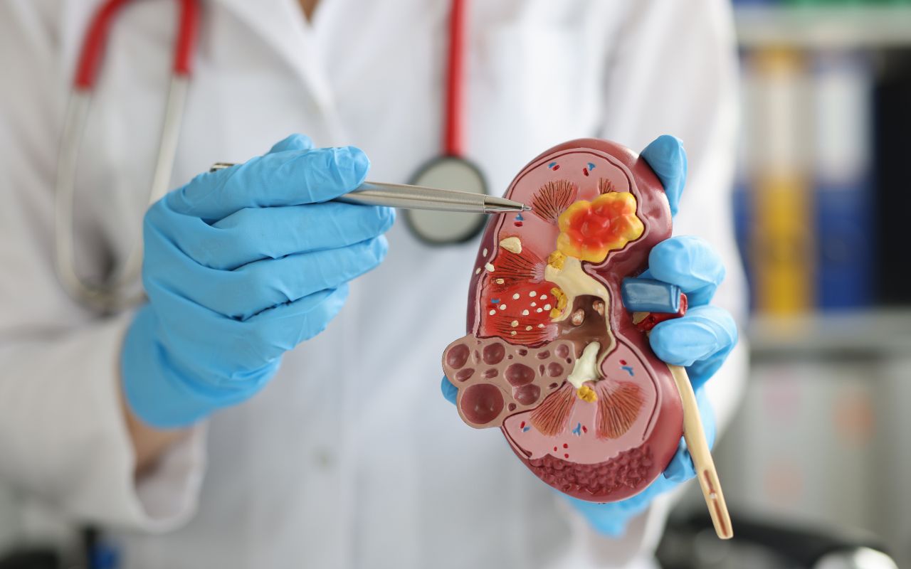 Bệnh Thận Mạn Tính Nên Ăn Gì? Thực Đơn Bảo Vệ Thận