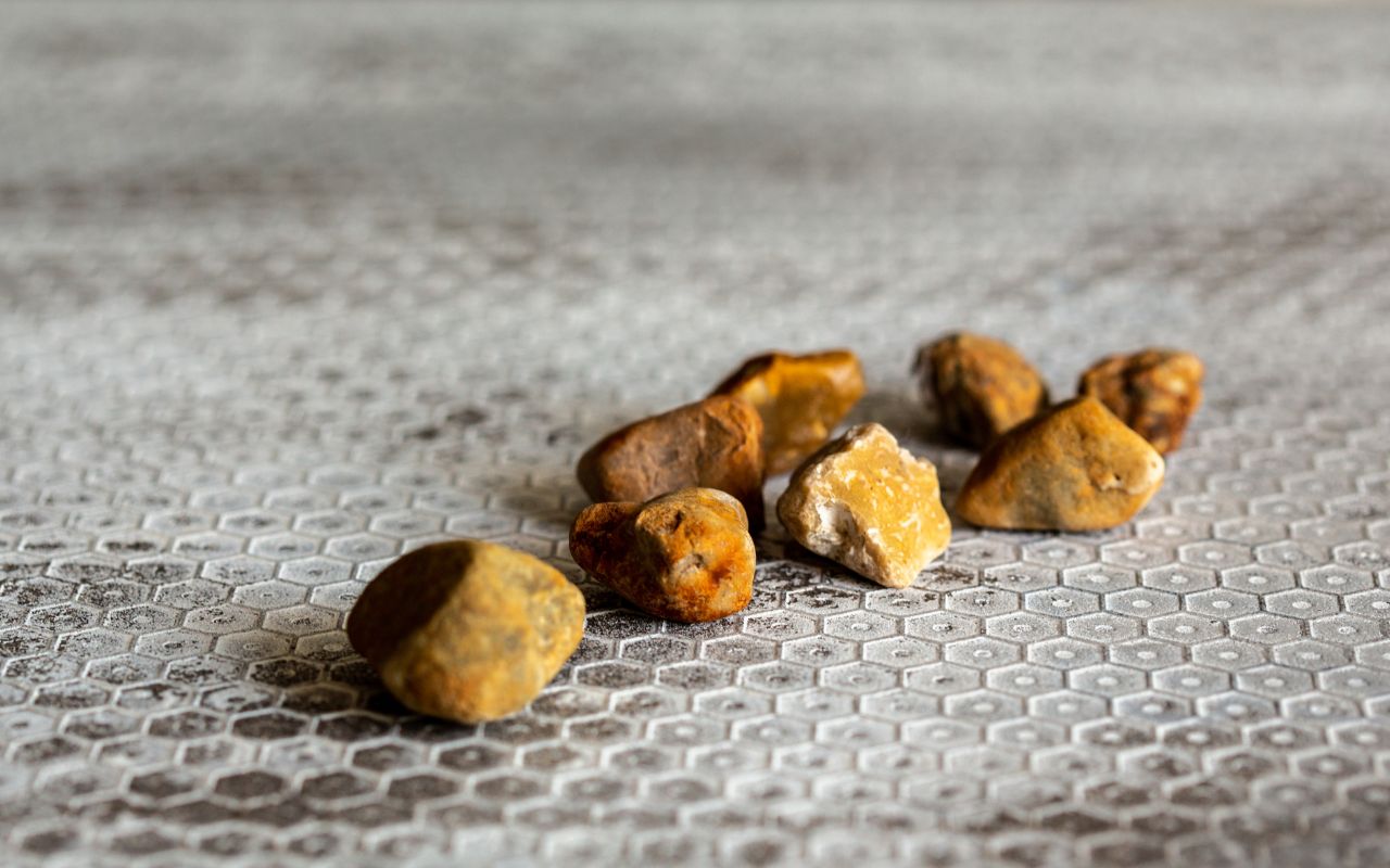 Sỏi Mật Nên Ăn Gì? Thực Đơn Giảm Nguy Cơ Tái Phát