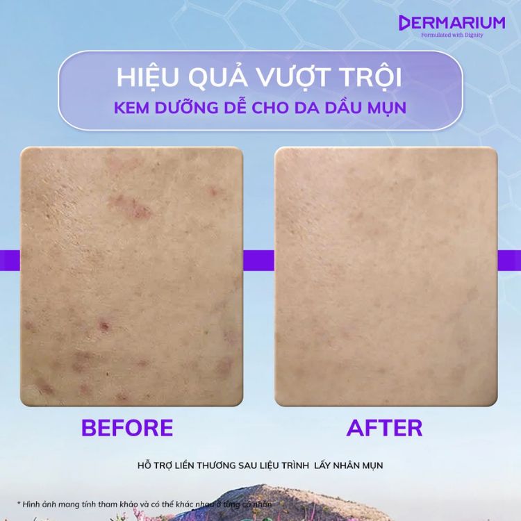 Dermarium Moisturiser Ease