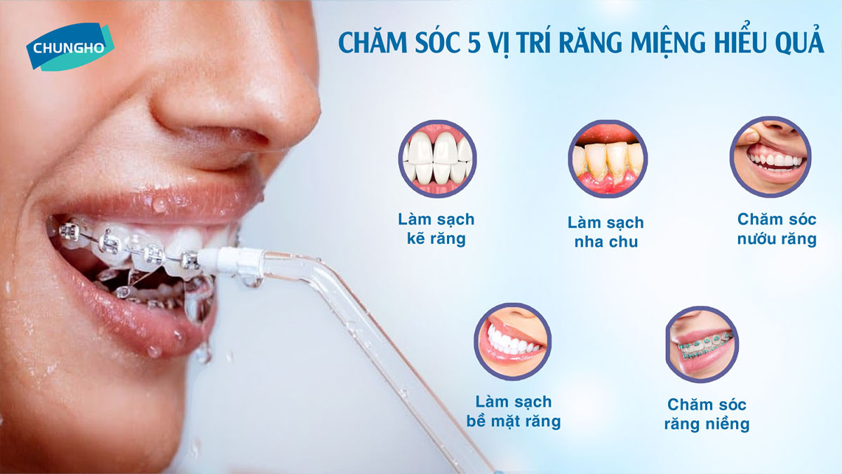 Máy tăm nước ChungHo HF-12: Thiết kế cầm tay, 5 mức áp lực, 6 đầu tăm, chống nước IPX7