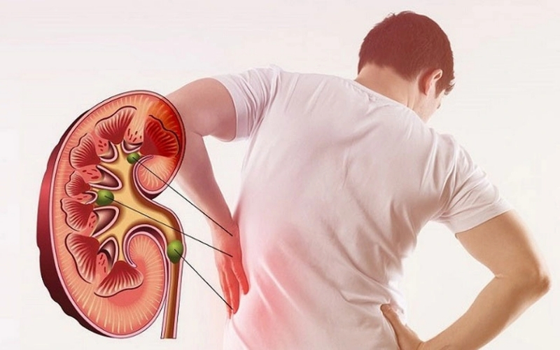 Điều quan trọng là người bệnh thận nên xây dựng chế độ ăn dựa trên tư vấn y tế hoặc chuyên gia dinh dưỡng lâm sàng, trong đó khẩu phần trái cây, lượng nước và nguồn đạm được điều chỉnh phù hợp.@internet