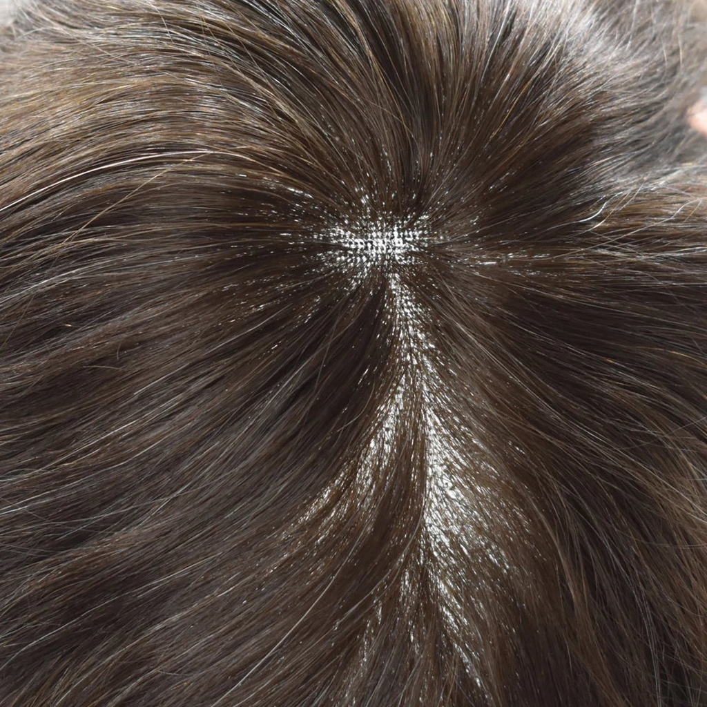 Tóc Giả Nam Che Hói - Kiểu Basic Mái Xéo Bằng Tóc Thật | Wina