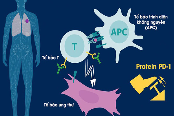 Giải pháp toàn diện để thoát khỏi ung thư