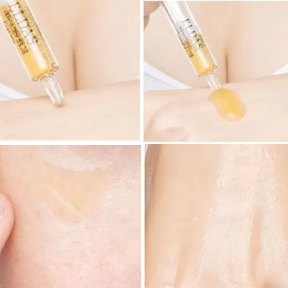 Tế Bào Gốc Phục Hồi Tái Tạo Da Eldas Eg Tox Program Coreana 4 Ống