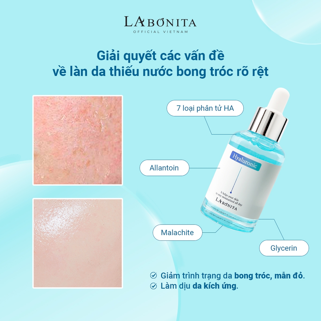Tinh Chất Dưỡng Ẩm Sáng Da & Tăng Độ Đàn Hồi Da La Bonita Vital Hyaluronic Acid Serum 50ml